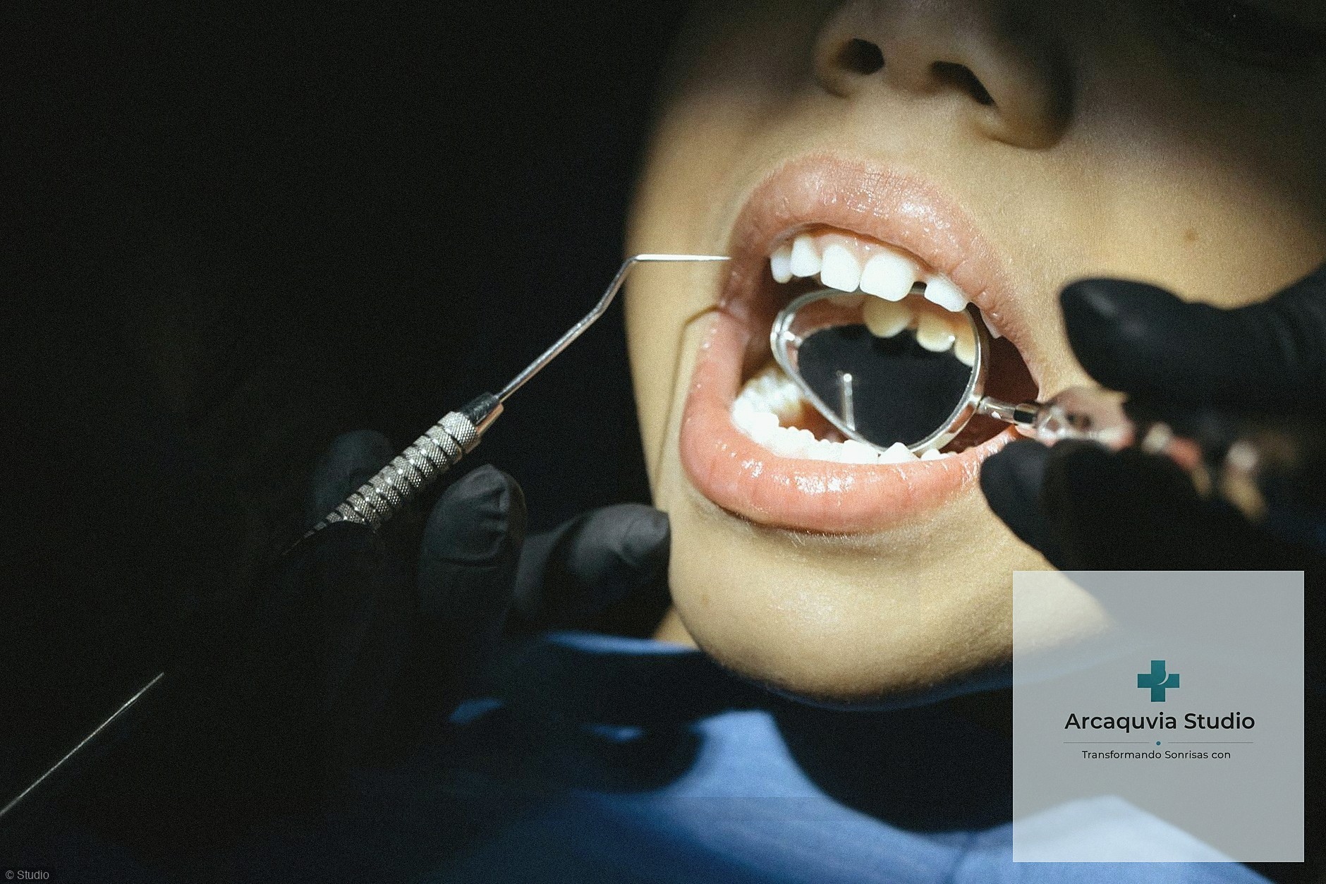 Blanqueamiento Dental con Componentes Naturales